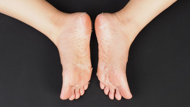 bai-viet/tinh-trang-bong-da-chan-nguyen-nhan-va-cach-khac-phuc.html