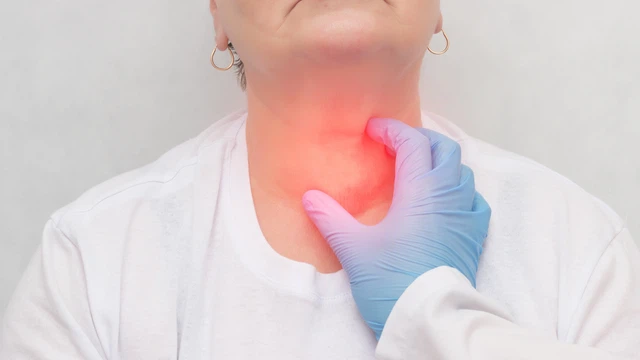 Bướu cổ (Bướu giáp): Dạng rối loạn tuyến giáp phổ biến