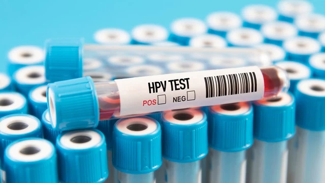 bai-viet/huong-dan-cach-doc-ket-qua-xet-nghiem-hpv.html