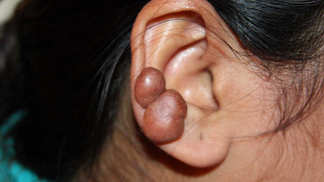 bai-viet/cach-khac-phuc-seo-loi-ngay-cang-to-56358.html
