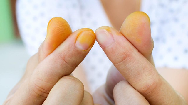 bai-viet/cach-tay-nghe-tuoi-dinh-tren-tay-hieu-qua.html