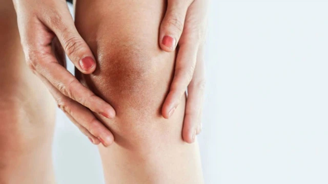 bai-viet/cach-tri-tham-dau-goi-tai-nha-don-gian-hieu-qua-moi-nguoi-nen-biet.html