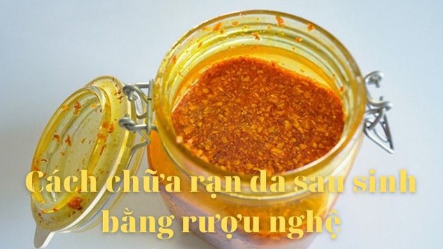 bai-viet/chi-tiet-cach-tri-ran-da-sau-sinh-bang-ruou-nghe-56802.html