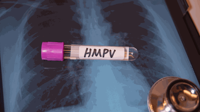 bai-viet/chu-dong-ung-pho-voi-dich-benh-do-virus-hmpv.html