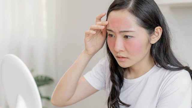 bai-viet/chua-chay-nang-cho-da-mat-voi-4-cong-thuc-don-gian-tai-nha.html
