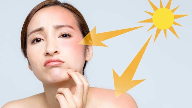 bai-viet/da-mat-bi-chay-nang-lam-sao-de-trang-lai.html