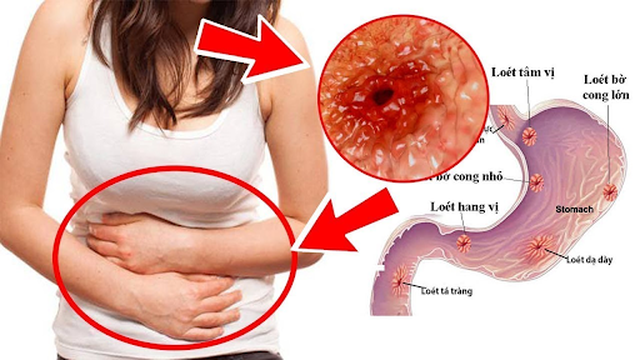 bai-viet/dau-da-day-nguyen-nhan-hau-qua-va-cach-khac-phuc-49828.html