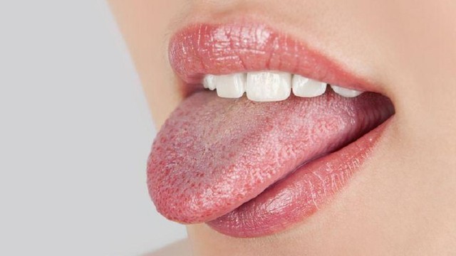 bai-viet/noi-mun-o-luoi-la-dau-hieu-cua-benh-gi-co-dieu-tri-duoc-khong.html