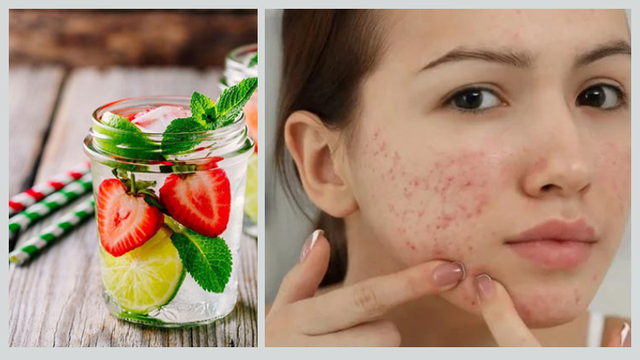 bai-viet/detox-thai-doc-tri-mun-loi-ich-cach-thuc-hien-va-mot-so-luu-y.html