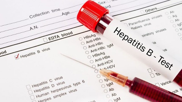 bai-viet/dinh-luong-hbv-dna-am-tinh-co-y-nghia-nhu-the-nao.html