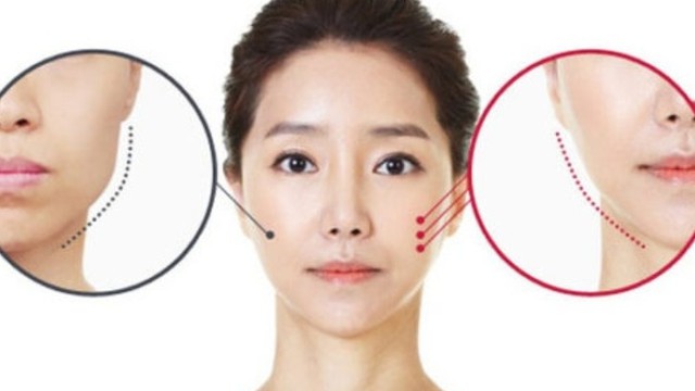 bai-viet/giai-dap-mat-lech-ben-trai-thi-nhai-ben-nao-cach-khac-phuc-mat-lech.html