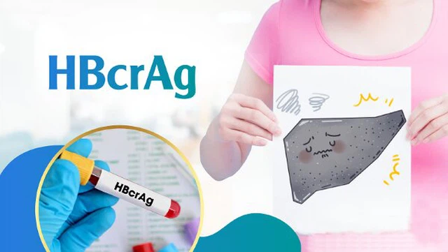 bai-viet/h-bcr-ag-la-gi-gia-tri-cua-dau-an-huyet-thanh-h-bcr-ag-la-gi.html