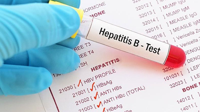 bai-viet/hbv-dna-la-gi-y-nghia-cua-xet-nghiem-hbv-dna.html