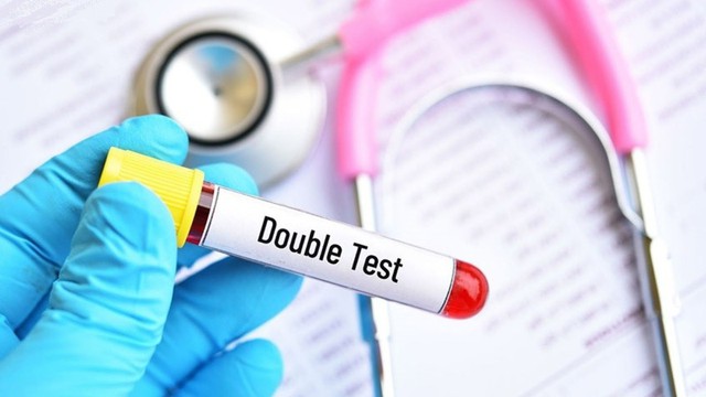 bai-viet/hieu-ve-cach-doc-ket-qua-xet-nghiem-double-test-nhung-dieu-cha-me-can-biet.html