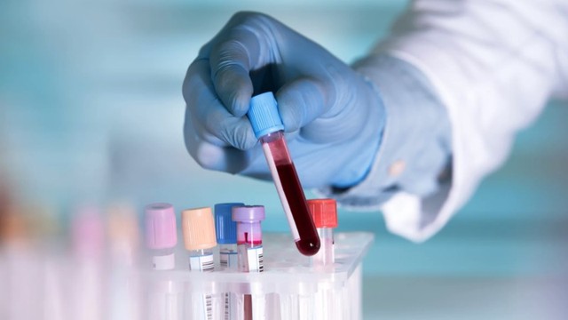 bai-viet/hoi-chung-khang-phospholipid-la-gi-trieu-chung-va-dieu-tri-nhu-the-nao-70655.html