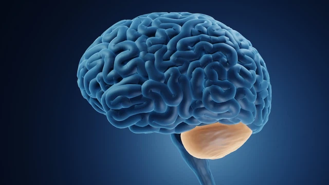 Hội chứng tiểu não: Nguyên nhân, triệu chứng, phương pháp điều trị 1