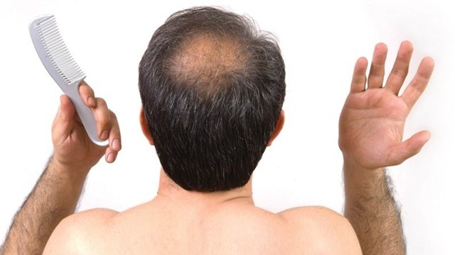 bai-viet/hoi-dau-do-dau-nguoi-bi-hoi-dau-co-chua-duoc-khong.html