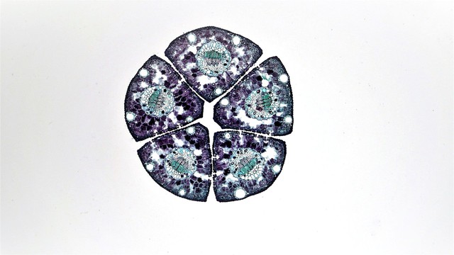 bai-viet/hyperplasia-la-gi-su-khac-biet-giua-tang-san-va-phi-dai-la-gi.html