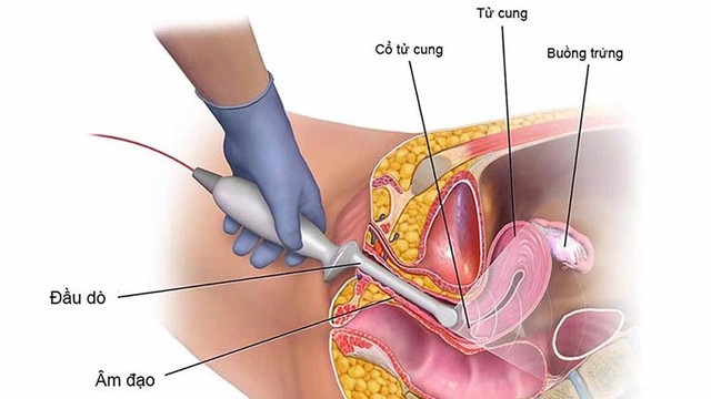 bai-viet/khau-eo-co-tu-cung-co-di-lai-duoc-khong.html