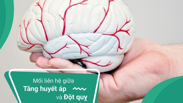 bai-viet/moi-lien-he-giua-tang-huyet-ap-va-xuat-huyet-nao-khong-phai-ai-cung-biet.html