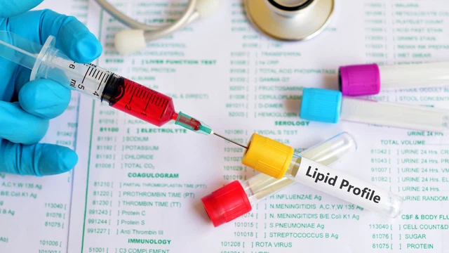 bai-viet/muc-tieu-dieu-tri-roi-loan-lipid-mau-va-cac-phuong-phap-dieu-tri.html