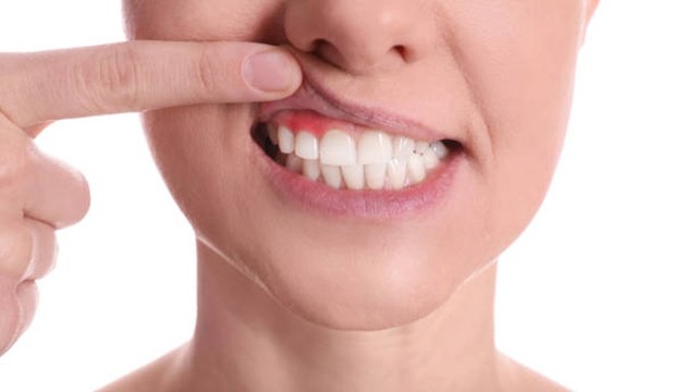 bai-viet/mucous-membrane-la-gi-cau-tao-vi-tri-va-vai-tro-1.html