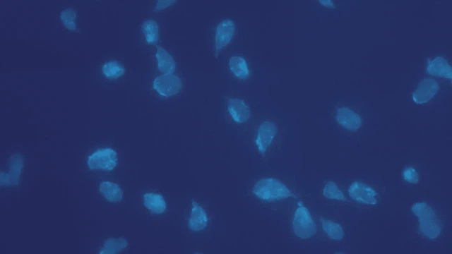 benh/nhiem-balantidium-192.html