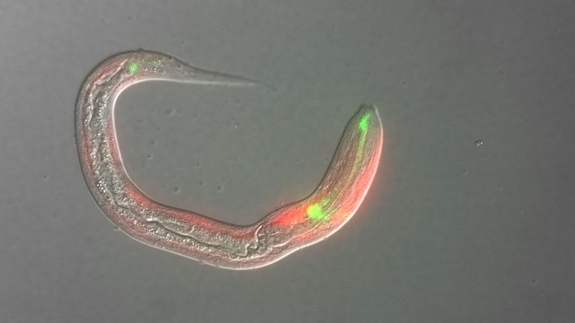 bai-viet/nhiem-strongyloides-stercoralis-la-gi-nguyen-nhan-trieu-chung-va-dieu-tri.html