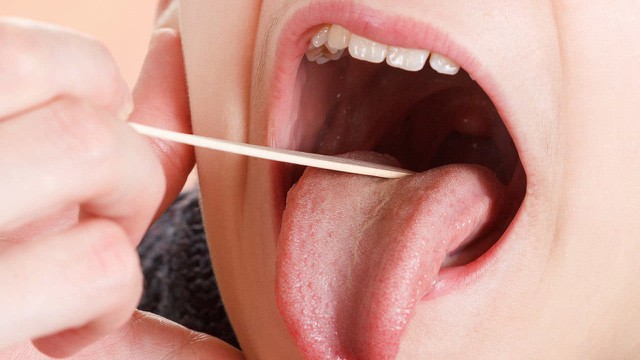 bai-viet/nhung-thoi-quen-giup-ngua-viem-amidan-66997.html