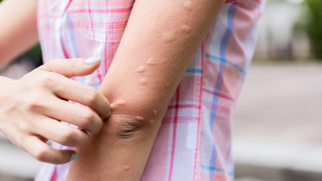 bai-viet/nhung-thong-tin-can-biet-ve-me-day-cholinergic-54289.html