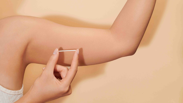 Những thông tin cơ bản về que cấy tránh thai​ không phải ai cũng biết