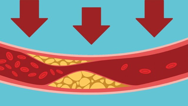 bai-viet/non-hdl-cholesterol-la-gi-va-tam-quan-trong-cua-no-doi-voi-suc-khoe.html