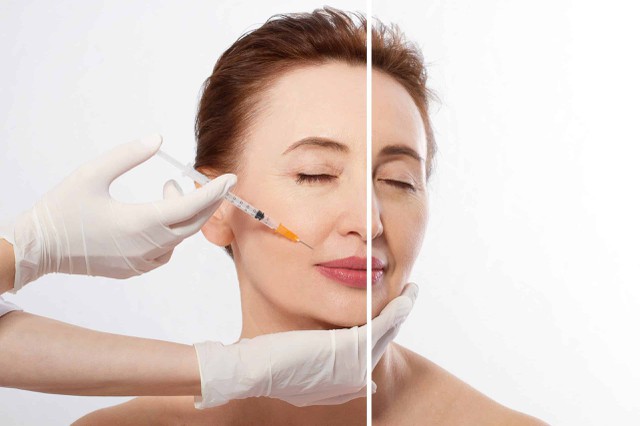 bai-viet/phan-biet-2-phuong-phap-lam-dep-tiem-filler-botox-48465.html
