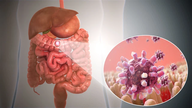 bai-viet/phan-biet-tieu-chay-do-vi-khuan-va-virus-de-biet-cach-xu-ly-hieu-qua.html