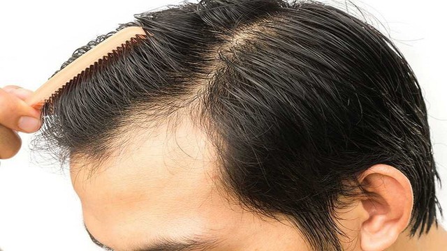 bai-viet/phuong-phap-cay-toc-co-hieu-qua-khong-66345.html
