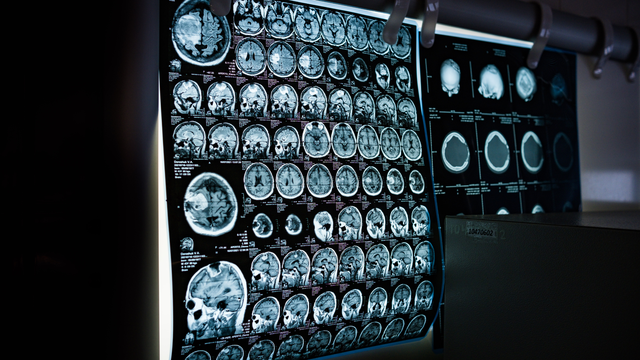 bai-viet/phuong-phap-mri-moi-co-the-du-doan-nguy-co-mac-benh-tim-bang-cach-phan-tich-mo-tim.html