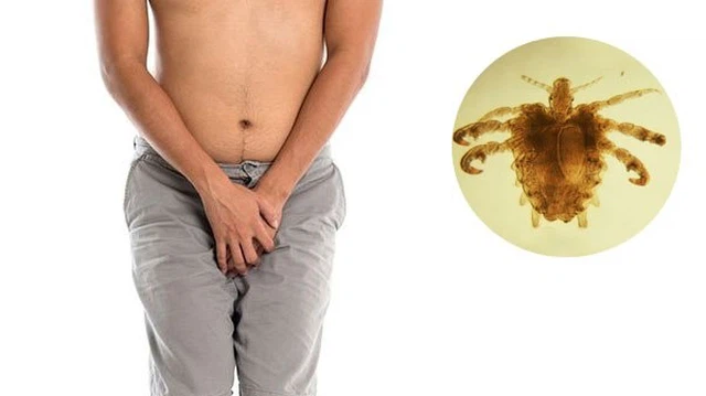 bai-viet/nhung-thong-tin-can-biet-ve-ran-mu-o-nam-gioi-64101.html