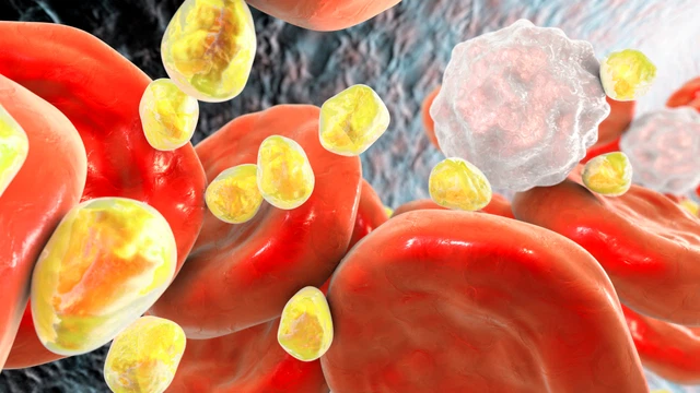 benh/roi-loan-lipid-mau-1272.html