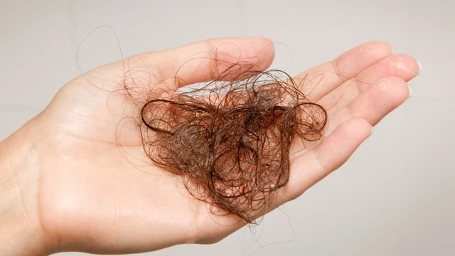 Rụng tóc nhiều khi gội đầu có bất thường không?