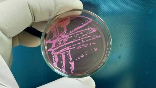 bai-viet/vi-khuan-shigella-dysenteriae-tac-nhan-gay-ly-truc-khuan-va-cac-bien-phap-phong-ngua.html