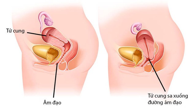 bai-viet/sieu-am-co-phat-hien-sa-tu-cung-khong.html