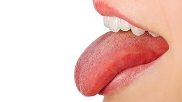 bai-viet/bieu-hien-cua-cac-giai-doan-phat-trien-ung-thu-luoi-ban-khong-nen-bo-qua.html
