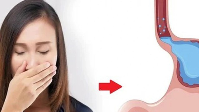 bai-viet/soi-bung-o-hoi-buon-non-la-dau-hieu-cua-benh-ly-nao.html