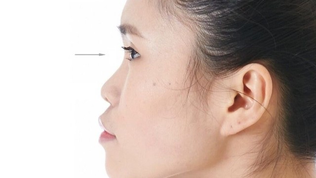 bai-viet/song-mui-lom-la-nhu-the-nao-co-khac-phuc-duoc-khong.html