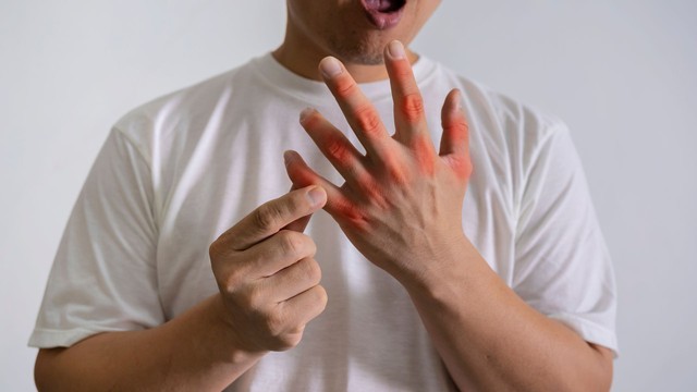 bai-viet/stress-lam-tang-nguy-co-mac-benh-gout-axit-uric-cao-nhu-the-nao.html