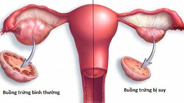 bai-viet/suy-giam-buong-trung-co-nen-thu-tinh-ong-nghiem-51349.html
