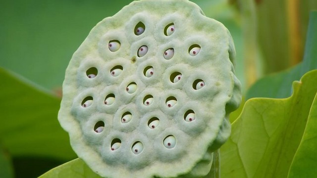 bai-viet/test-hoi-chung-so-lo-la-gi-nguyen-nhan-va-cach-dieu-tri-hoi-chung-so-lo-67863.html