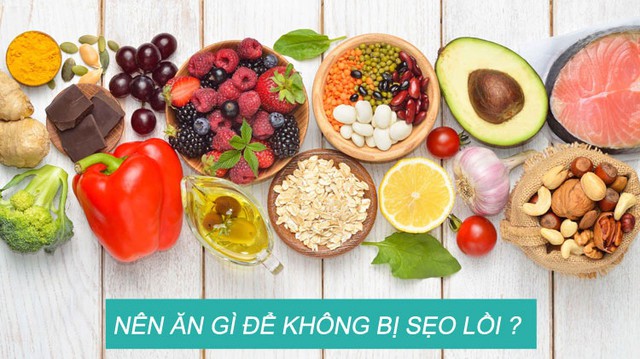 bai-viet/tim-hieu-seo-loi-kieng-an-gi-55074.html
