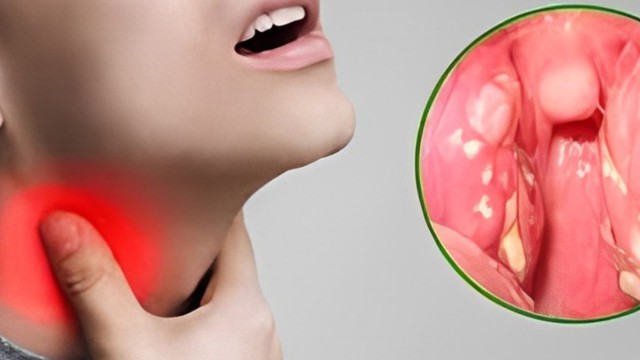 bai-viet/tinh-hinh-dich-bach-hau-o-nuoc-ta-va-cac-bien-phap-phong-ngua.html