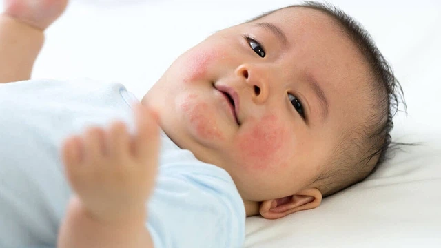 bai-viet/cham-soc-tre-so-sinh-bi-noi-mun-nuoc-nhu-the-nao.html